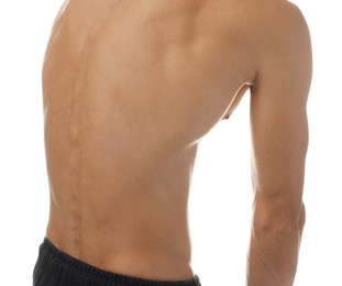 Photo of Man suffering from anorexia on white background, closeup