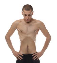 Photo of Man suffering from anorexia on white background