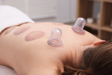 Photo of Cupping therapy. Woman with plastic cups on her back in spa salon, closeup