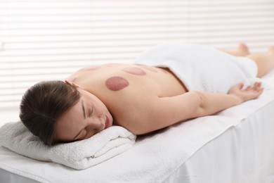 Photo of Woman after cupping therapy in spa salon