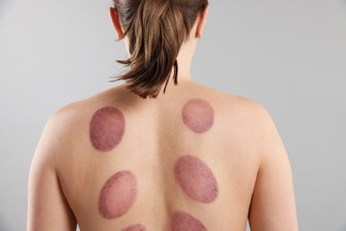 Photo of Woman after cupping therapy on gray background, closeup