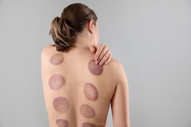Photo of Woman after cupping therapy on gray background, back view