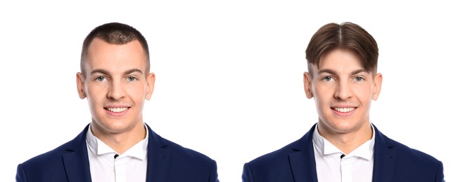 Image of Baldness. Man before and after wearing wig or hair treatment, collage