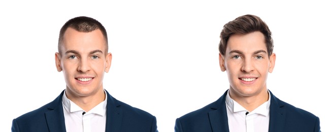 Image of Baldness. Man before and after wearing wig or hair treatment, collage