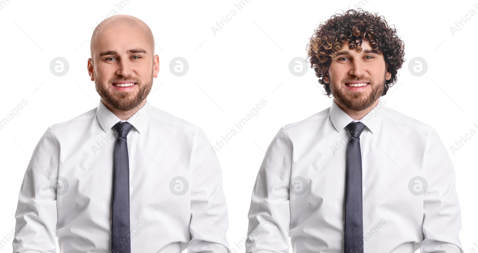 Baldness. Man before and after wearing wig or hair treatment, collage Image of Baldness. Man before and after wearing wig or hair treatment, collage