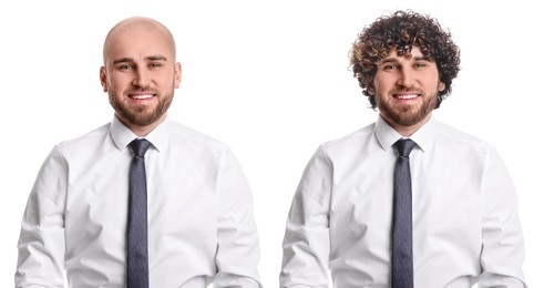 Image of Baldness. Man before and after wearing wig or hair treatment, collage