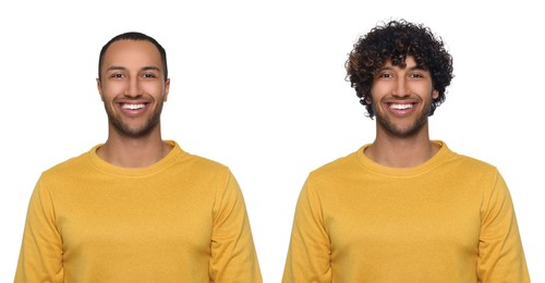 Image of Baldness. Man before and after wearing wig or hair treatment, collage