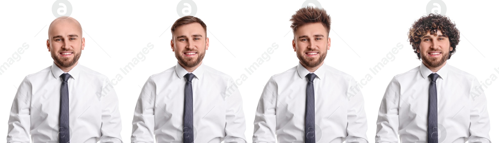 Baldness. Man before and after wearing wig or hair treatment, collage Image of Baldness. Man before and after wearing wig or hair treatment, collage