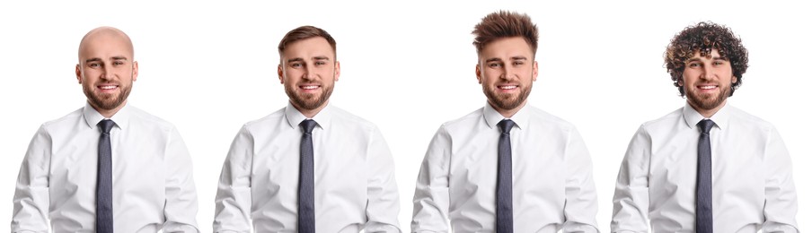 Image of Baldness. Man before and after wearing wig or hair treatment, collage