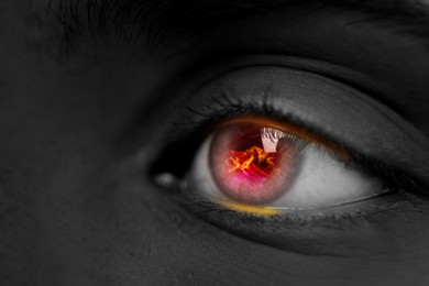 Image of Woman with fire burning in her eye, closeup. Black and white effect