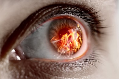 Image of Woman with fire burning in her eye, closeup