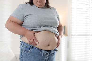 Photo of Woman with excessive belly fat indoors, closeup. Overweight problem