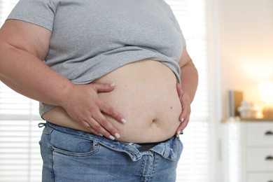 Photo of Woman with excessive belly fat indoors, closeup. Overweight problem