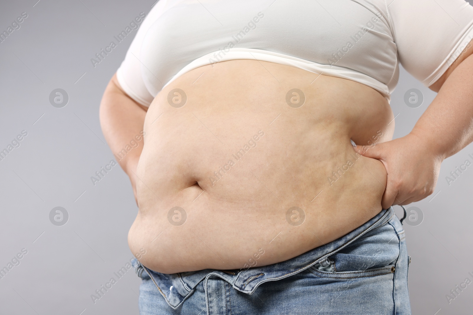 Woman with excessive belly fat on grey background, closeup. Overweight problem Photo of Woman with excessive belly fat on grey background, closeup. Overweight problem