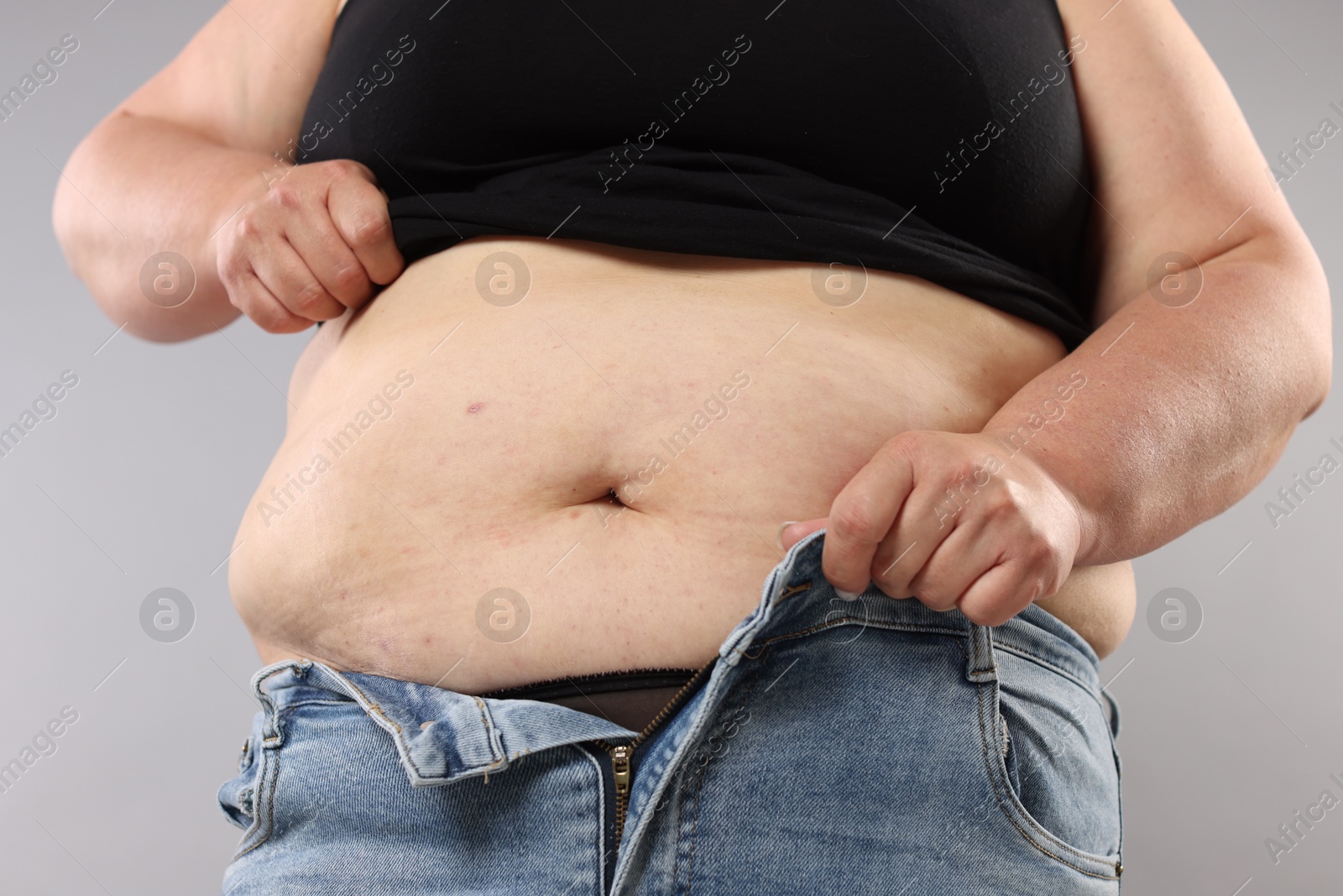 Woman with excessive belly fat on grey background, closeup. Overweight problem Photo of Woman with excessive belly fat on grey background, closeup. Overweight problem