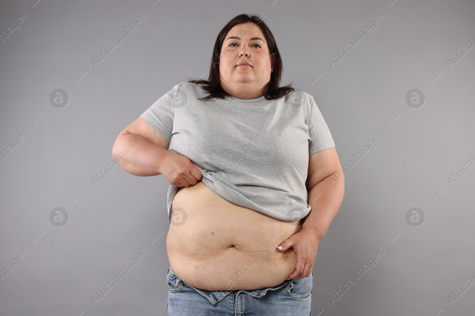 Woman with excessive belly fat on grey background Photo of Woman with excessive belly fat on grey background