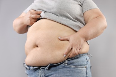 Photo of Woman with excessive belly fat on grey background, closeup