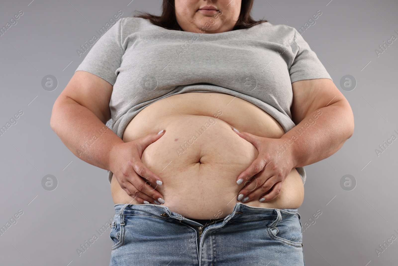 Woman with excessive belly fat on grey background, closeup Photo of Woman with excessive belly fat on grey background, closeup