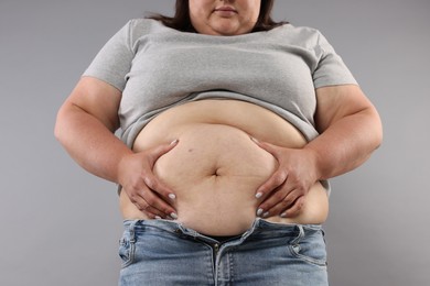 Photo of Woman with excessive belly fat on grey background, closeup