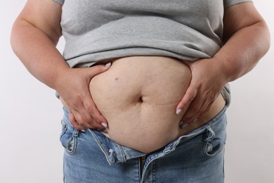 Photo of Woman with excessive belly fat on white background, closeup