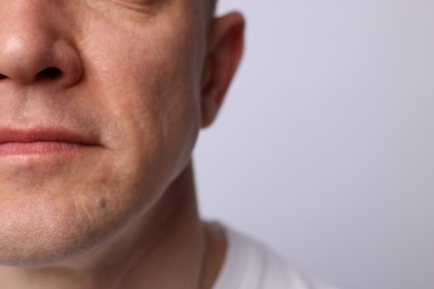 Photo of Clean shaven man on light background, closeup. Space for text