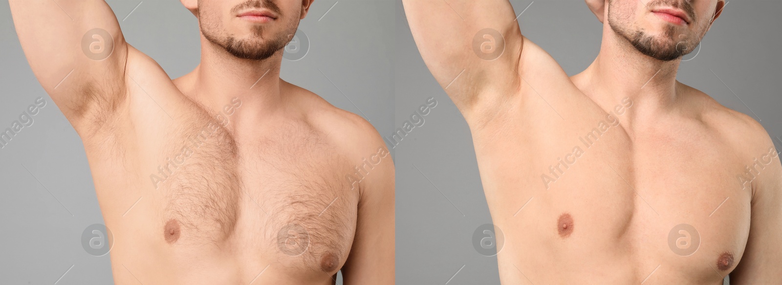 Before and after epilation. Collage with photos of man showing armpit and chest on grey background, closeup Image of Before and after epilation. Collage with photos of man showing armpit and chest on grey background, closeup