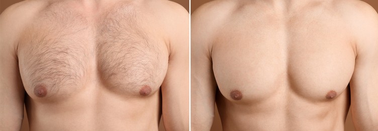 Image of Man showing chest before and after epilation procedure on brown background, closeup. Collage of photos