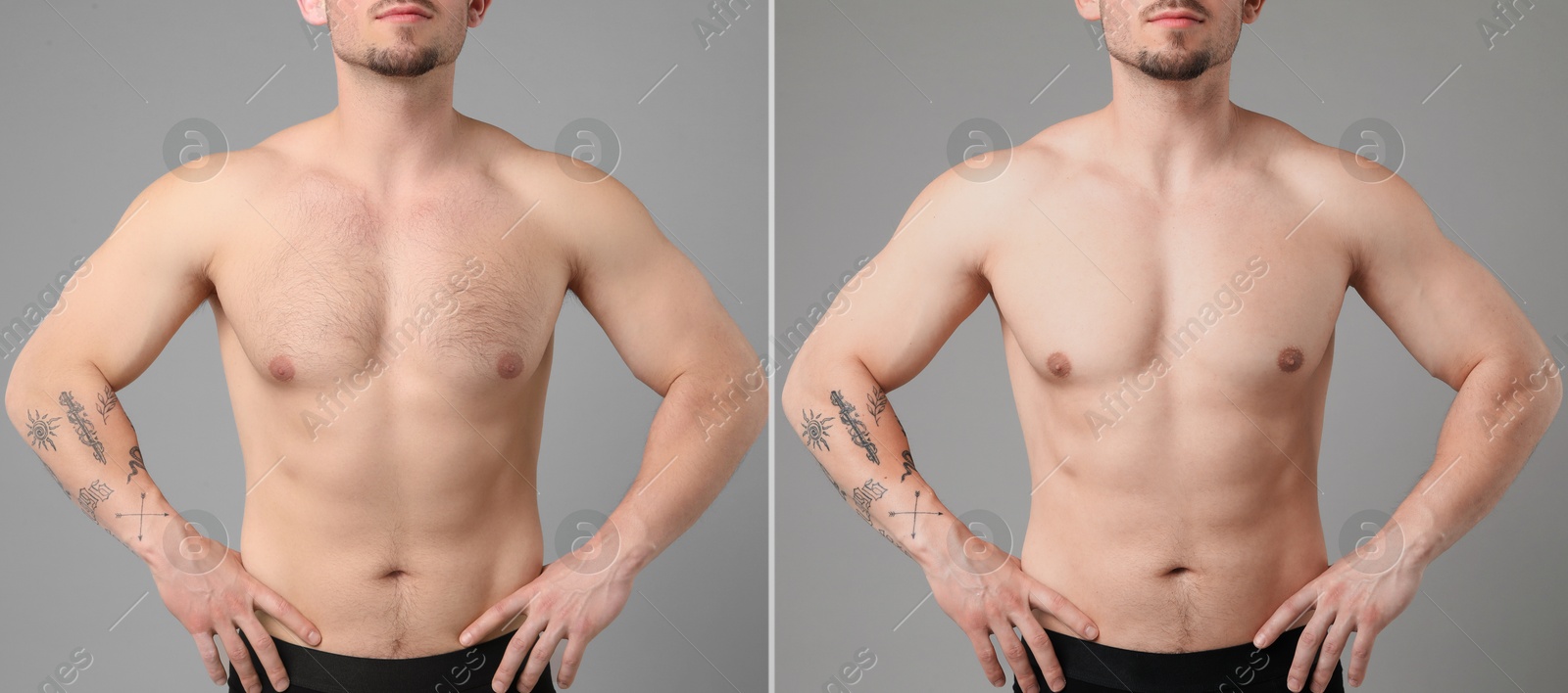 Image of Epilation. Collage with photos of man showing chest before and after procedure on grey background, closeup