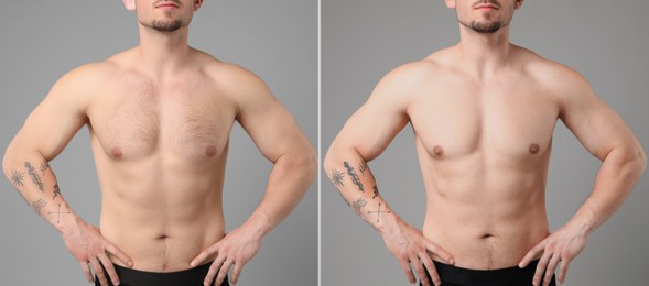 Image of Epilation. Collage with photos of man showing chest before and after procedure on grey background, closeup