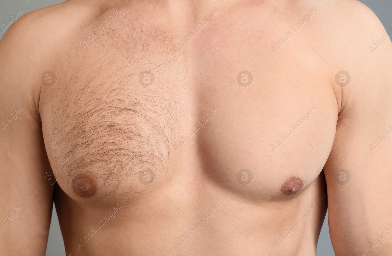 Man showing chest before and after epilation procedure on grey background, closeup Image of Man showing chest before and after epilation procedure on grey background, closeup