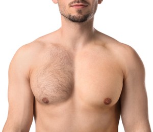 Image of Before and after epilation procedure. Man showing chest with left side unshaven and right smooth on white background, closeup