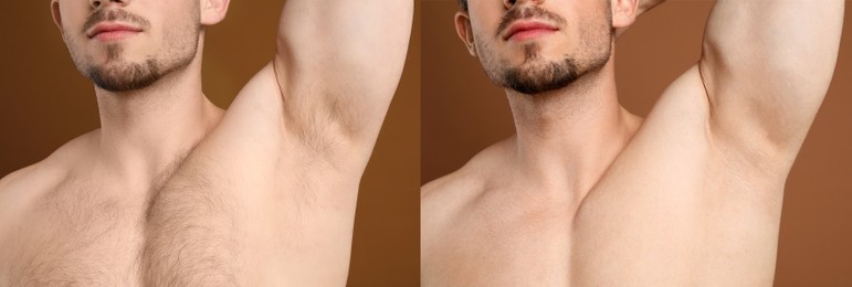 Image of Man showing armpit and chest before and after epilation procedure on brown background, closeup. Collage of photos
