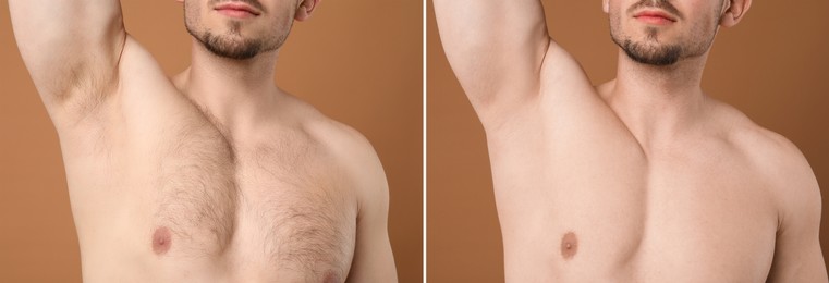 Image of Man showing armpit and chest before and after epilation procedure on brown background, closeup. Collage of photos