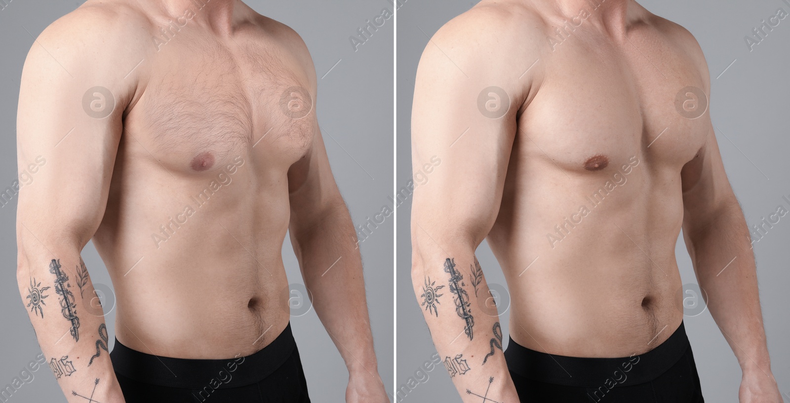 Before and after epilation. Collage with photos of man showing chest on grey background, closeup Image of Before and after epilation. Collage with photos of man showing chest on grey background, closeup