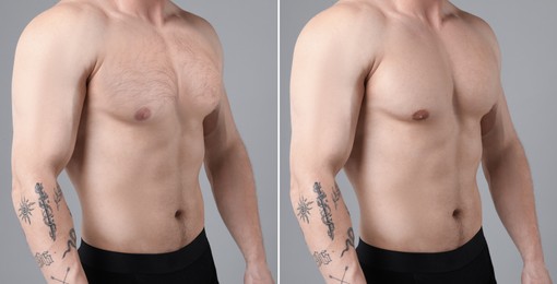 Image of Before and after epilation. Collage with photos of man showing chest on grey background, closeup