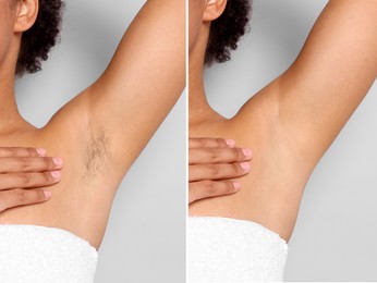 Image of Epilation, hair removal. Woman showing armpit before and after procedure on grey background, closeup. Collage