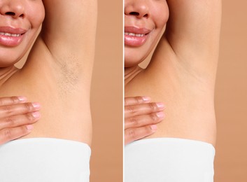 Image of Epilation, hair removal. Woman showing armpit before and after procedure on dark beige background, closeup. Collage