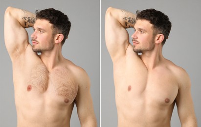 Image of Before and after epilation. Collage with photos of man showing armpit and chest on grey background