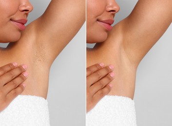 Image of Epilation and depilation. Collage with photos of woman showing armpit after different procedures on grey background, closeup