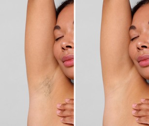 Image of Epilation, hair removal. Woman showing armpit before and after procedure on grey background, closeup. Collage