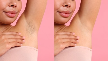 Image of Before and after epilation. Woman showing armpit on pink background, closeup. Collage