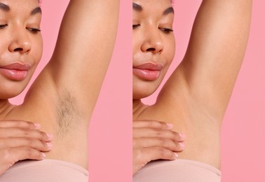 Image of Before and after epilation. Woman showing armpit on pink background, closeup. Collage