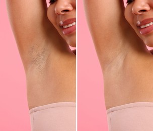 Image of Before and after epilation. Woman showing armpit on pink background, closeup. Collage