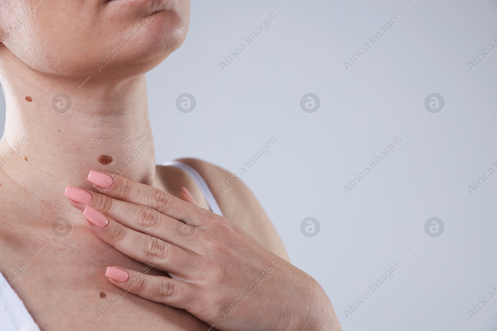 Woman with moles on her body against light background, closeup. Space for text Photo of Woman with moles on her body against light background, closeup. Space for text