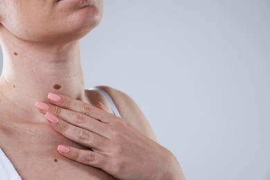 Photo of Woman with moles on her body against light background, closeup. Space for text
