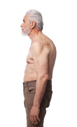 Photo of Senior man with bad posture on white background