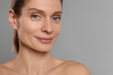 Image of Beautiful woman with perfect skin after collagen treatment on grey background, space for text. Arrows on her face illustrating lifting and smoothing effect