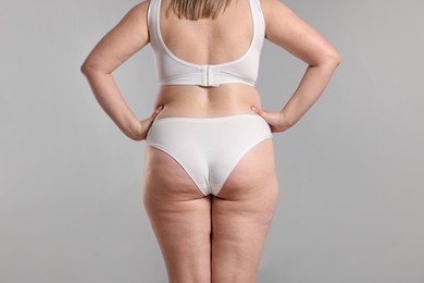 Photo of Weight loss. Plus size woman in underwear on gray background, closeup