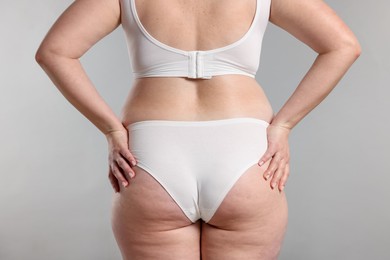 Photo of Weight loss. Plus size woman in underwear on gray background, closeup