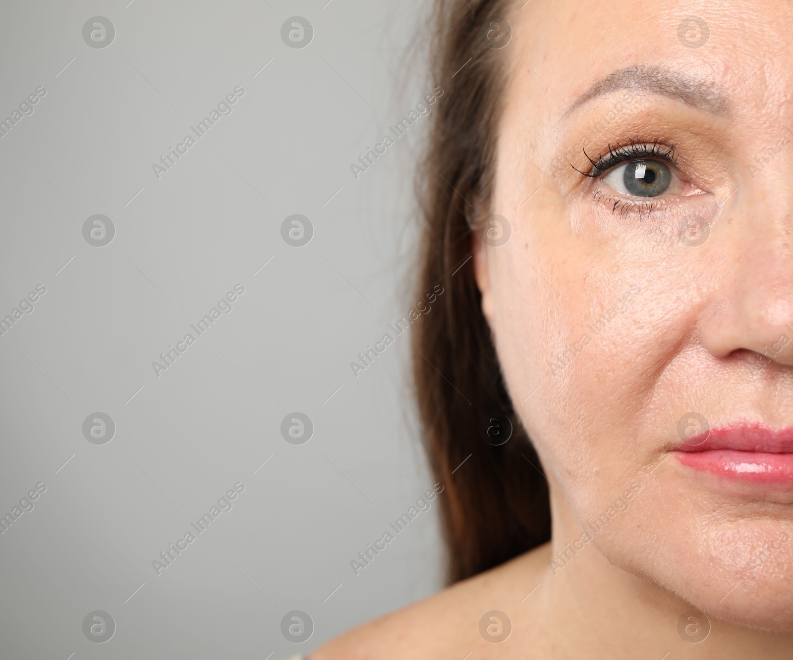 Woman before cosmetic procedure on grey background, closeup. Space for text Photo of Woman before cosmetic procedure on grey background, closeup. Space for text